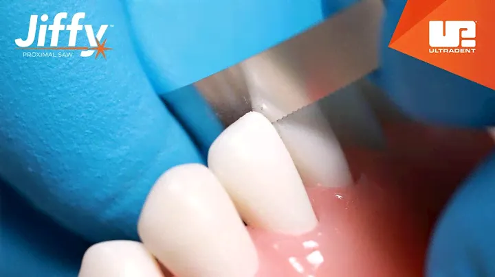 New Proximal Saws and Diamond Strips | Ultradent Products