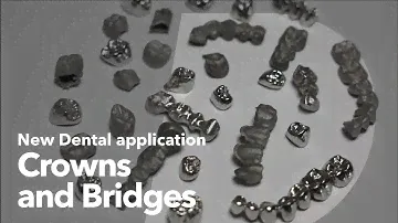 New dental application: Crowns and bridges